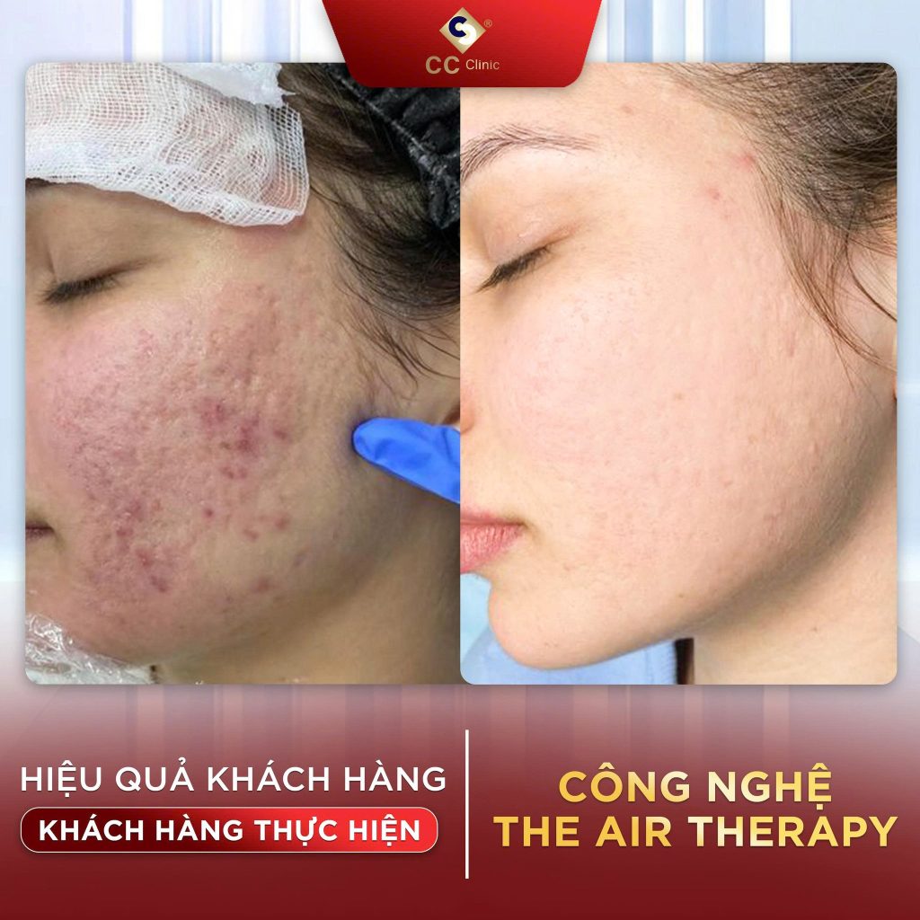 505541156_705249118920966_2713803221163647497_n