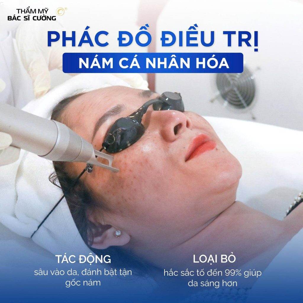 phác đồ điều trị nám tại thẩm mỹ BS Cường