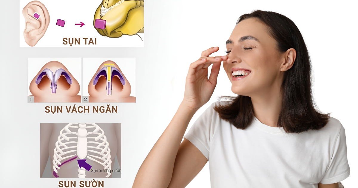 Nâng mũi sụn tự thân hay sụn nhân tạo