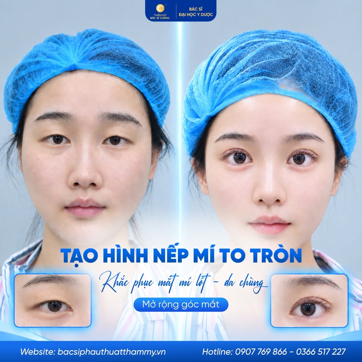 hạ lệ trung hoa là gì