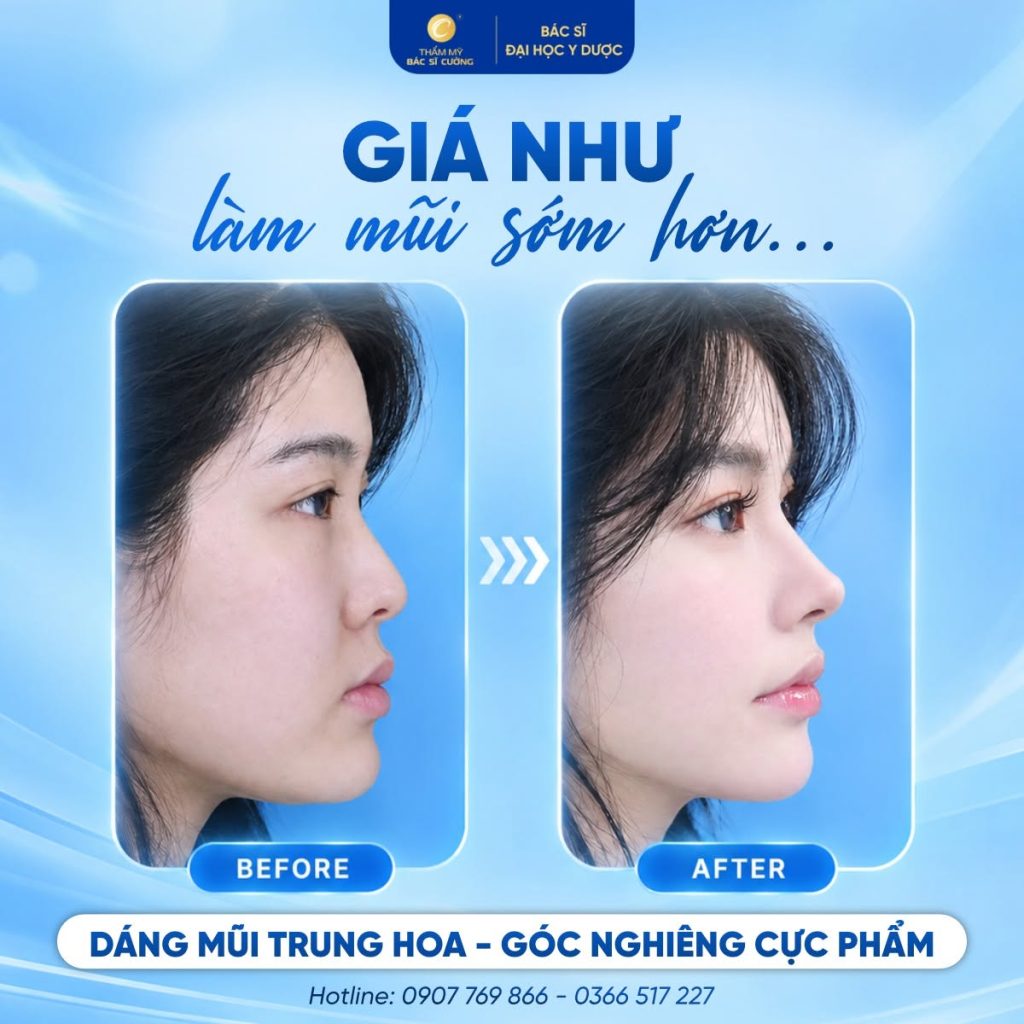 Dáng mũi Trung Hoa