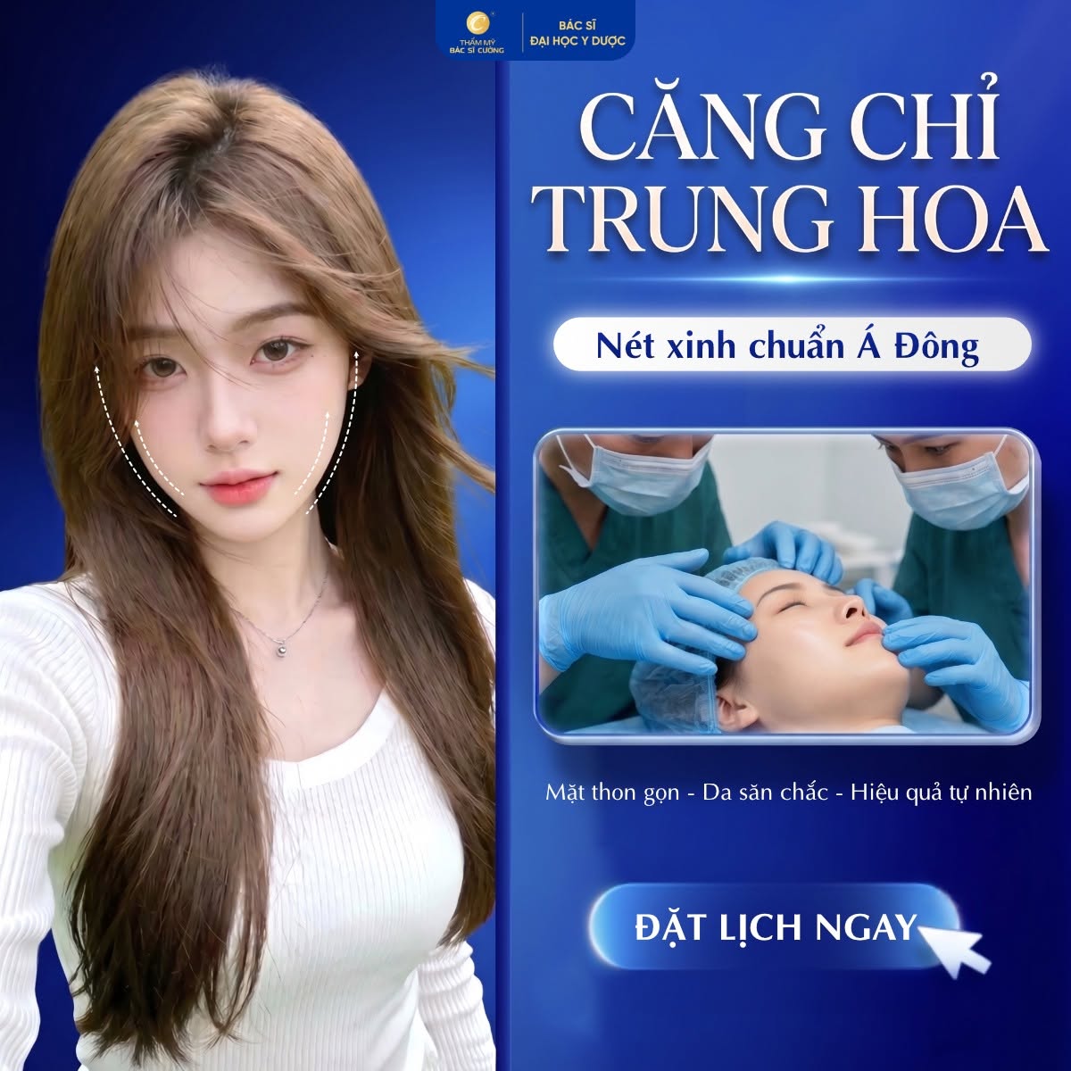 căng chỉ trung hoa