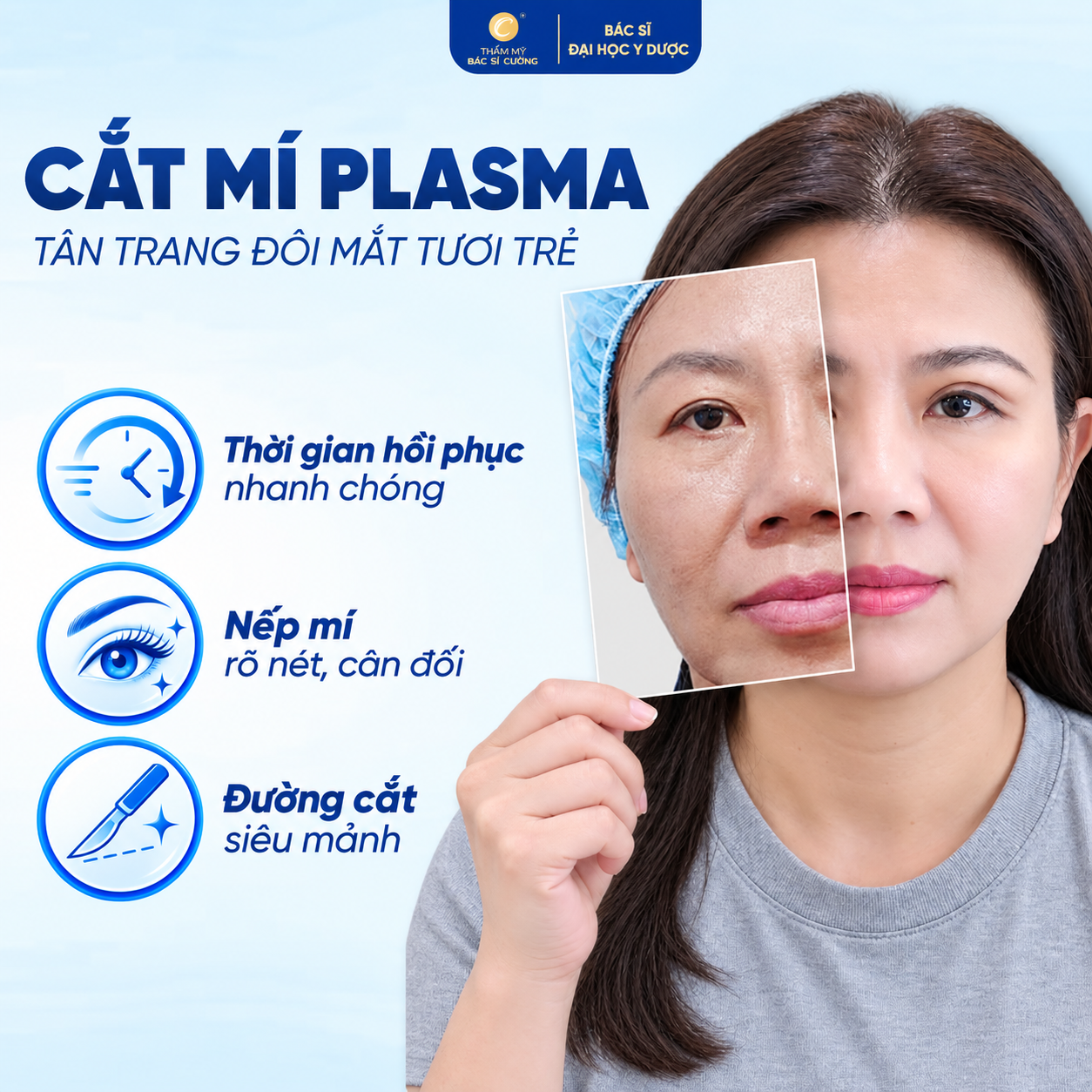 Cắt mí Plasma